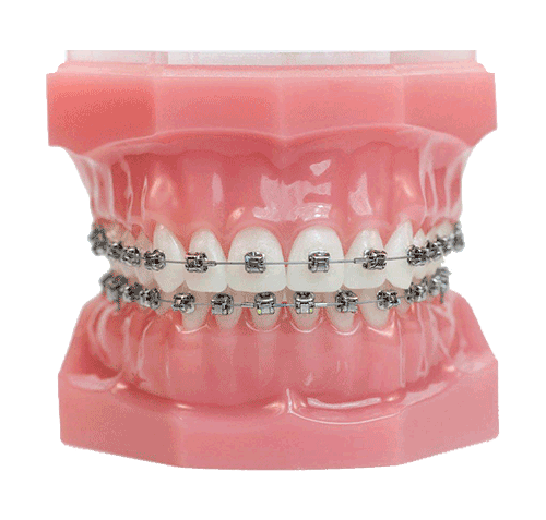 Invisalign Image